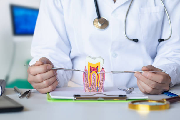 Best Emergency Wisdom Tooth Extraction in Sleepy Hollow, CA