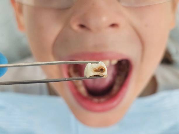 Best Walk-In Emergency Dental Services in Sleepy Hollow, CA